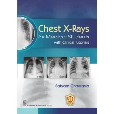 Chest X-rays For Medical Students With Clinical Tutorials. 1st Editin. 2023. Paperback